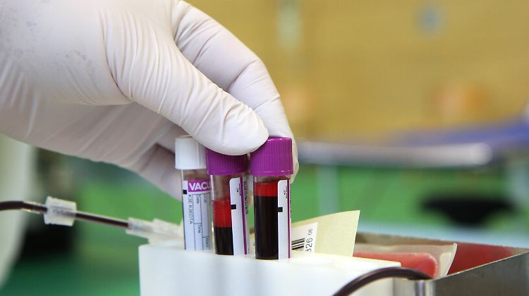 Ausländer müssen sich dem Gesetz zufolge etwa auf Tuberkulose, Drogenkonsum, Syphilis und HIV untersuchen lassen.