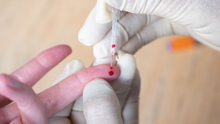 Ein kleiner Piks in den Finger und schon weiß man, wie gut man vor Corona geschützt ist? Wohl kaum, sagen Experten.