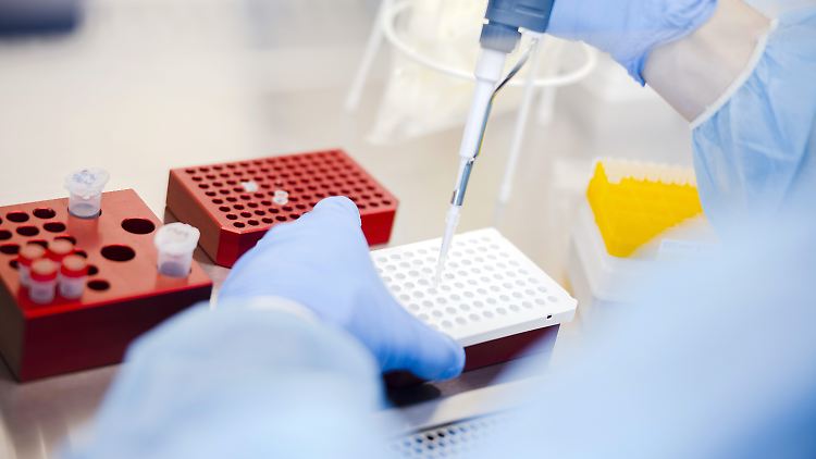 Wissenschaftler in Zypern haben nach eigenen Angaben 25 Deltakron-Fälle identifiziert.