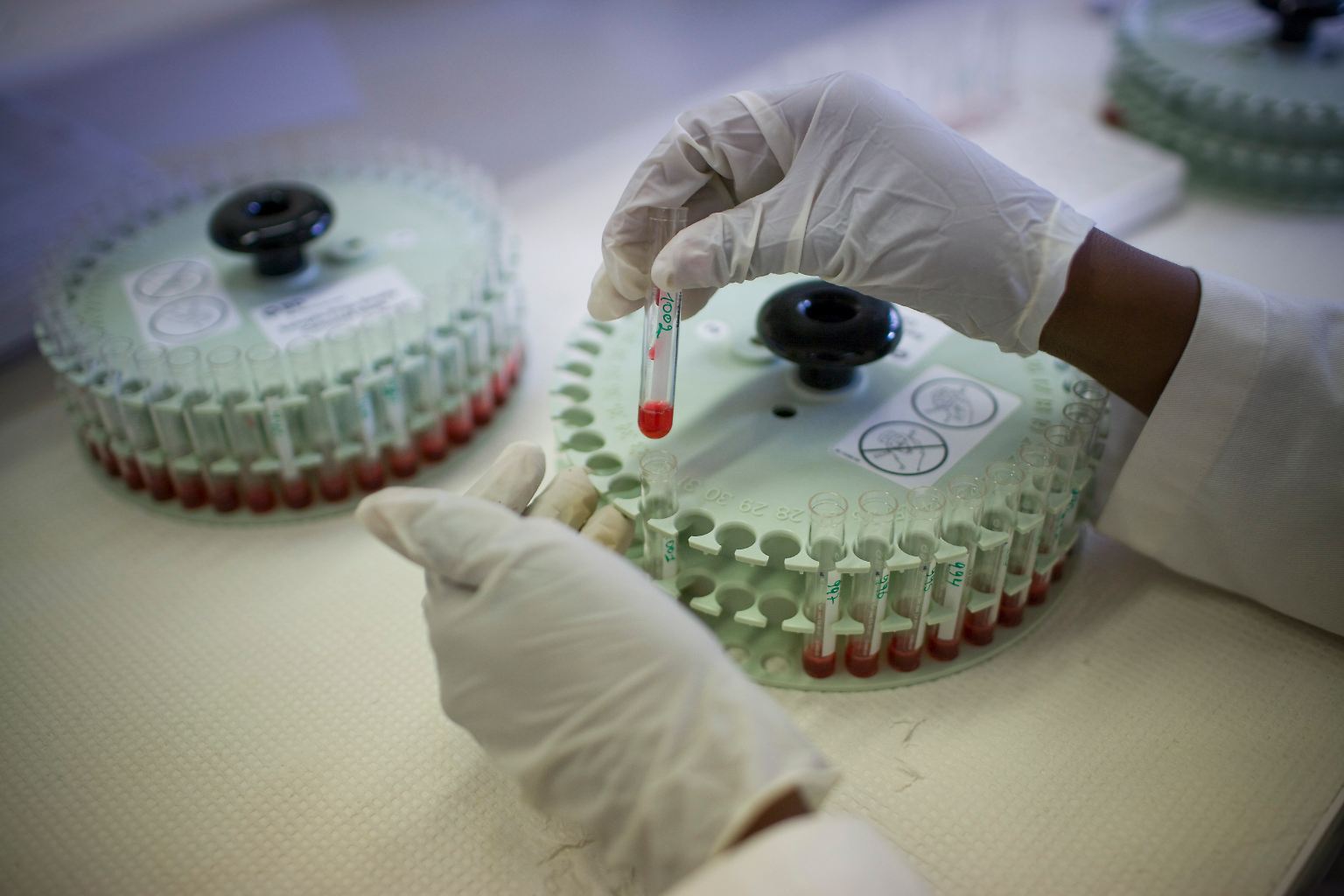 Vor 40 Jahren - 1982 - bekam die mysteriöse neue Krankheit, über die die US-Gesundheitsbehörde CDC erstmals im Juni 1981 berichtet hatte, den Namen AIDS.