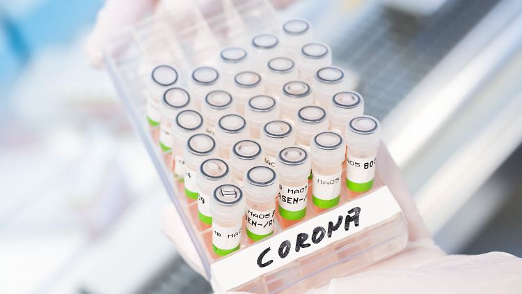 Die PCR-Testkapazitäten werden immer knapper.