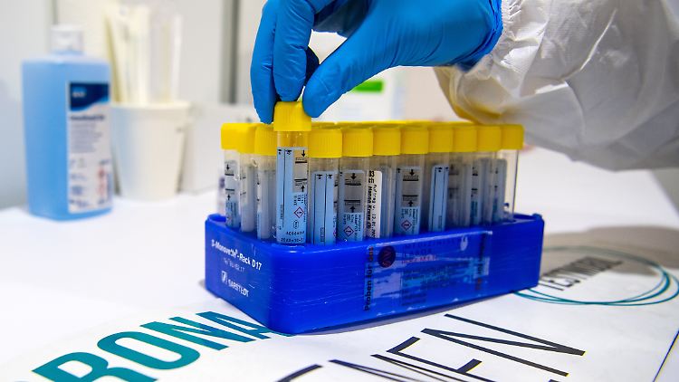 Ein positiver PCR-Test bedeutet nicht immer, dass man auch ansteckend ist.