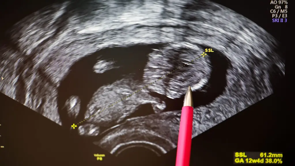 Alkoholkonsum-waehrend-der-Schwangerschaft-seitens-der-Mutter-kann-erhebliche-Schaedigungen-fuer-das-Kind-zur-Folge-haben