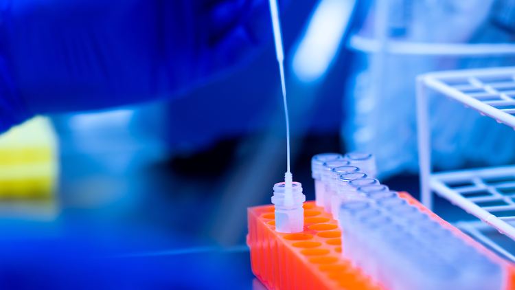 Bundesweit stoßen PCR-Testlabore an ihre Kapazitätsgrenzen.