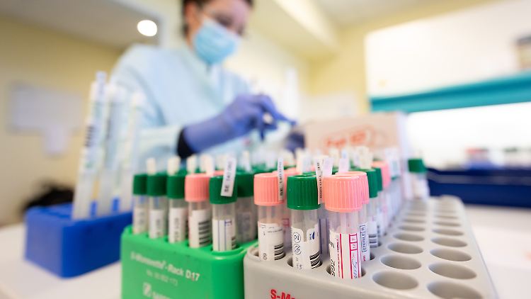 Die Omikron-Welle bringt eine Test-Flut in den Laboren mit sich, aber die Kapazitäten für PCR-Tests sind der Nachfrage nicht gewachsen.