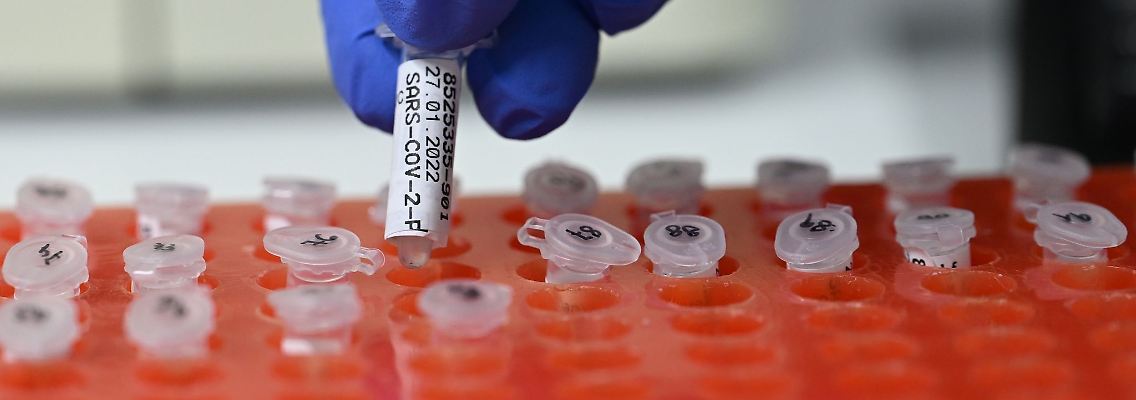 Eine Medizinische Mitarbeiterin bereitet PCR Tests vor.