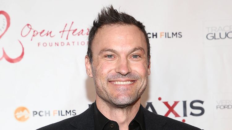 Litt unter Schlaganfall-ähnlichen Symptomen: Brian Austin Green.