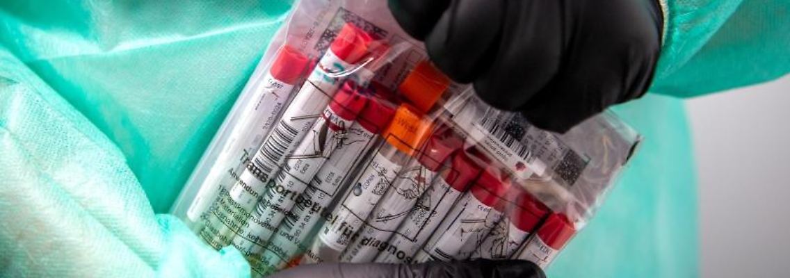 Das RKI veröffentlicht unter anderem Zahlen zum Testaufkommen in Deutschland.