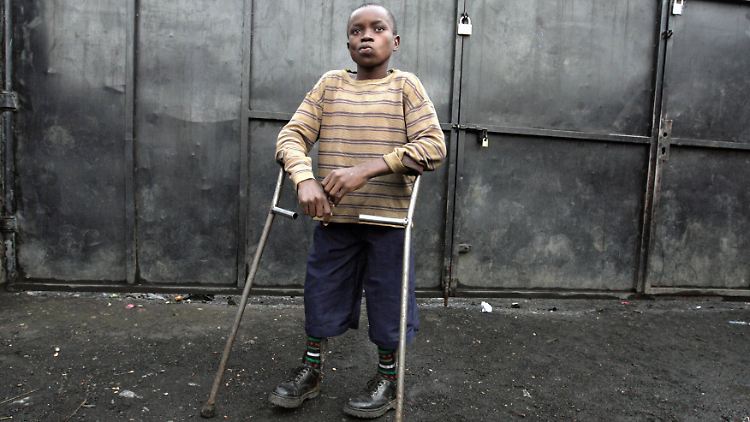 Polio greift das Rückenmark an und kann irreversible Lähmungen verursachen.