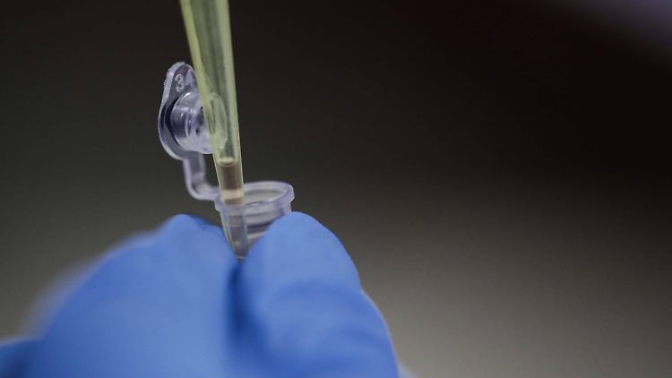 Der Omikron-Typ BA.2 unterscheidet sich laut einer neuen Studie deutlich von seinen Vorgängern.