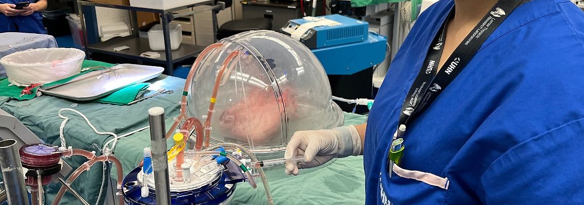ex-vivo-lung-perfusion.jpg