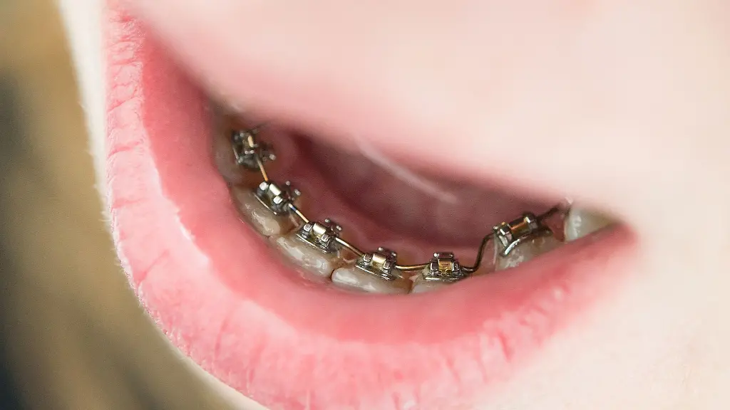 Fest-oder-lose-sichtbar-oder-unsichtbar-Archivbild