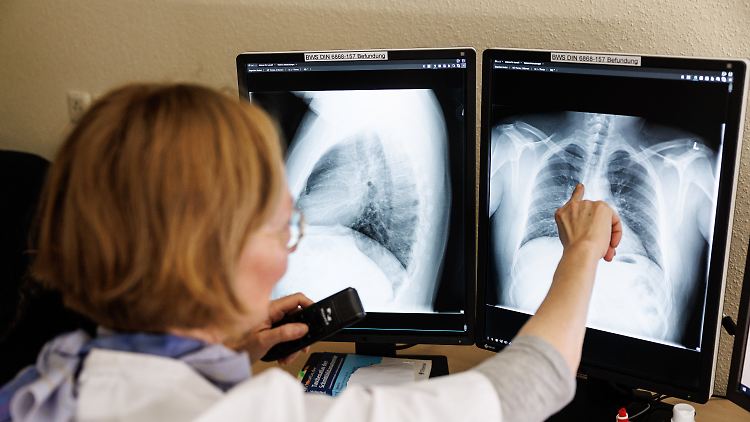 Auch in Deutschland sterben noch immer Menschen an Tuberkulose.
