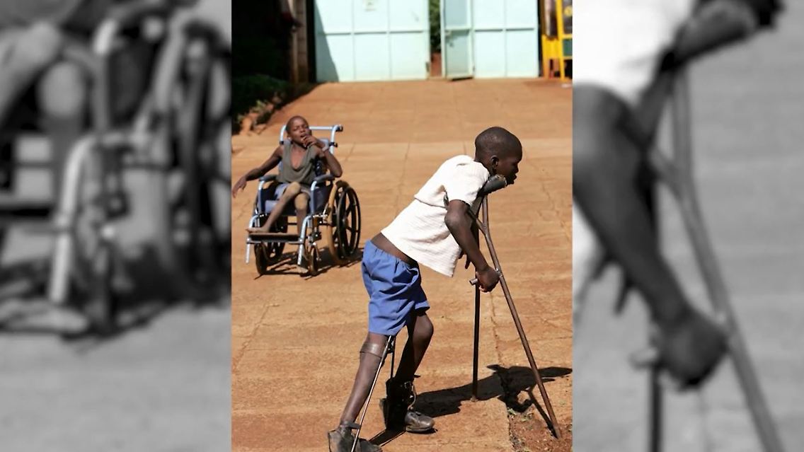 Polio Malawi.JPG