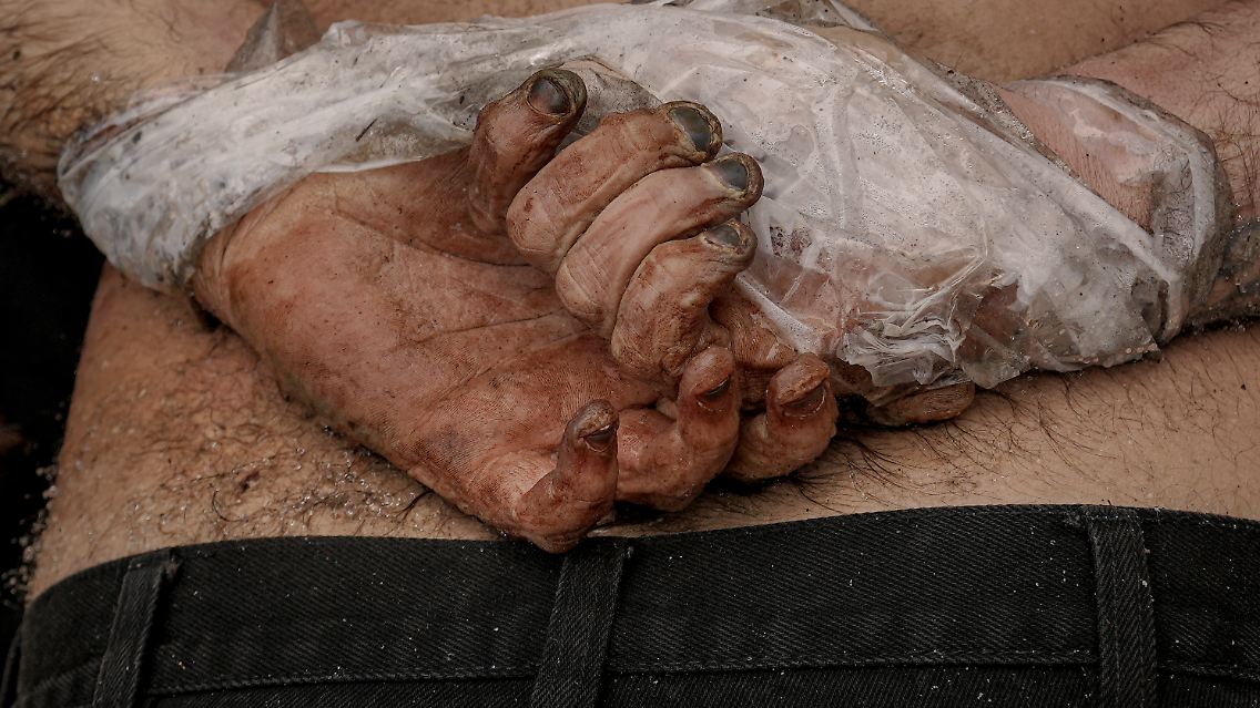 Leiche eines Zivilisten aus Butscha. AP-Fotografen sahen neun Tote mit eigenen Augen, zwei davon hatten auf dem Rücken gefesselte Hände.