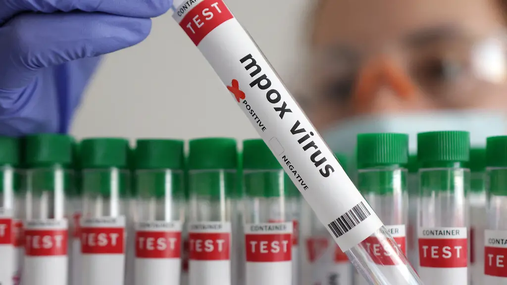 5538706068783b54af00192d22c51fdf