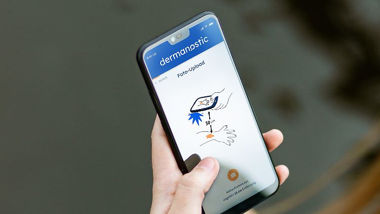 Diagnose auf dem Smartphone: Dermanostic hilft dabei, Hautkrankheiten zu diagnostizieren.
