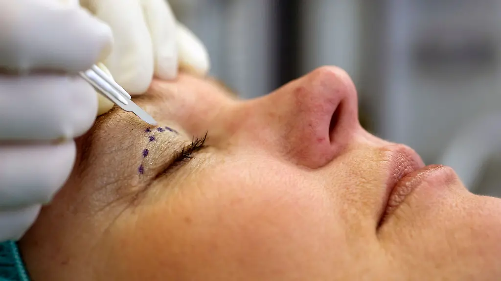 Schoenheits-OPs-im-Ausland-sind-beliebt-Doch-deutsche-Krankenkassen-uebernehmen-meist-keine-Folgekosten-fuer-misslungene-Eingriffe-weshalb-sorgfaeltige-Auswahl-und-eine-gute-Absicherung-entscheidend-sind