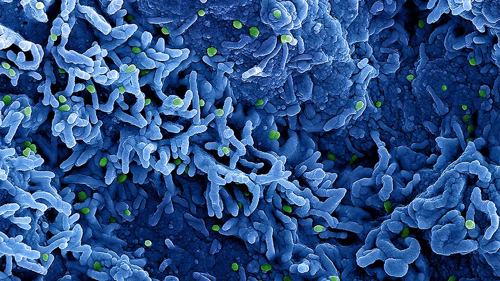 548d9452b78cec539af2e3a26fbe4dc2