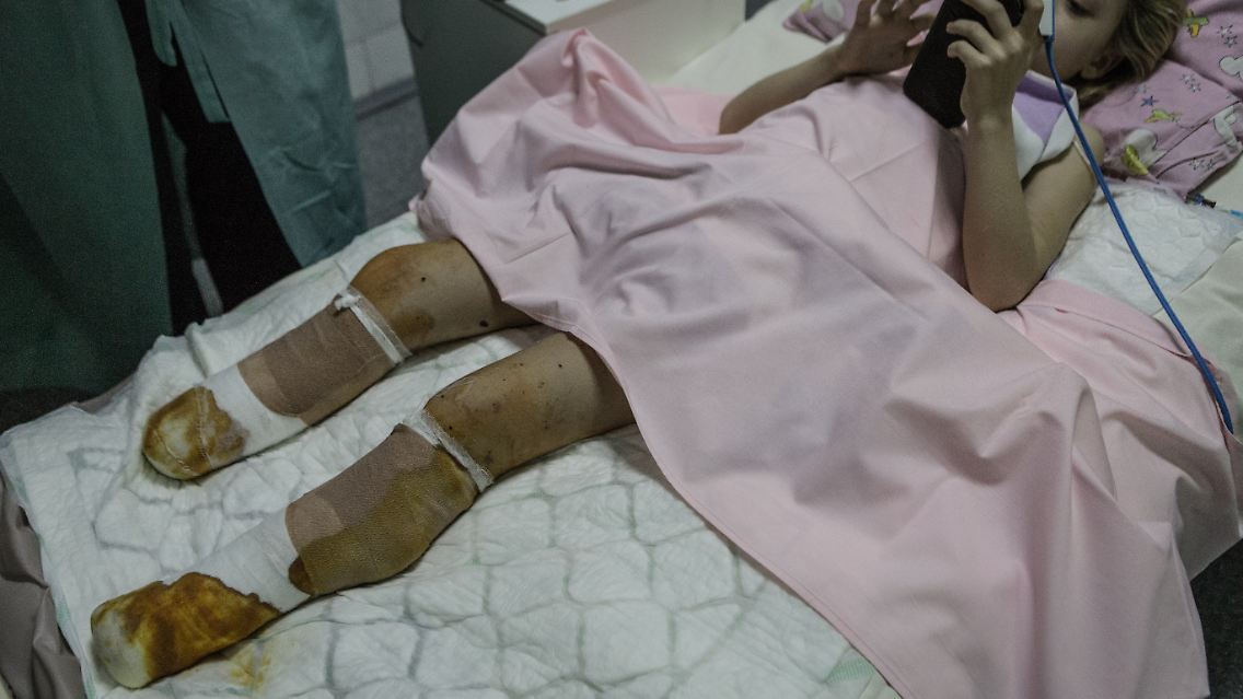In einer Klinik in Dnipro wird ein Kind, das beim Angriff auf den Bahnhof Kramatorsk verletzt wurde, gepflegt.