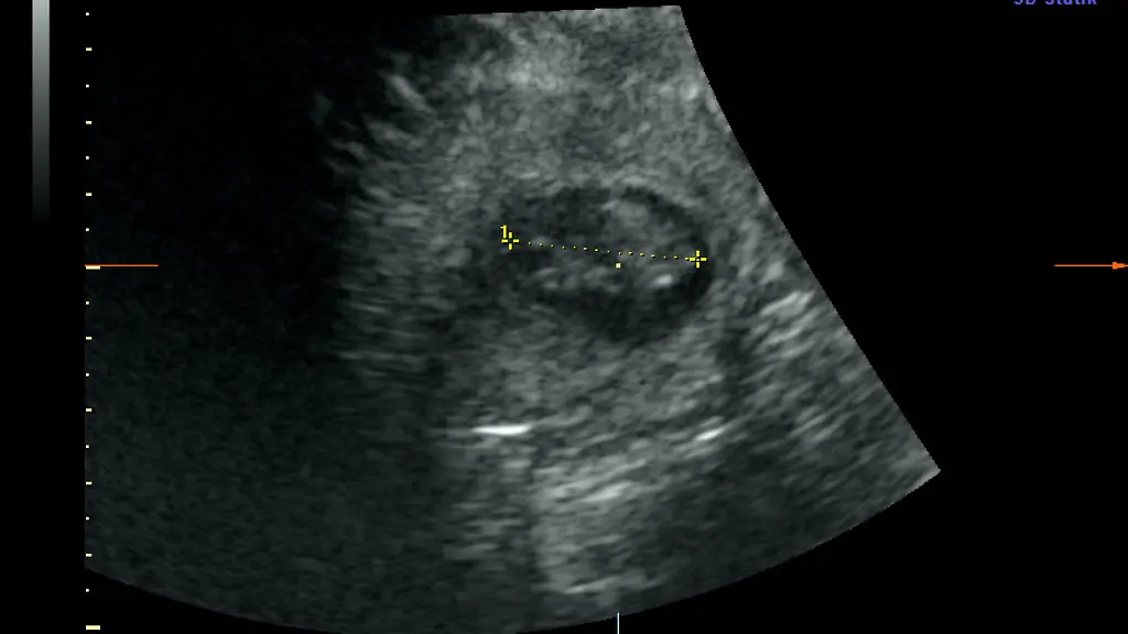 c0daaddbc2f3f3272b4265f8a5bee992