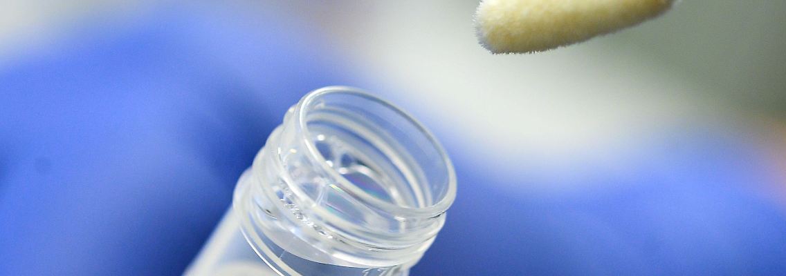 Ein Abstrich für das Testverfahren auf das Coronavirus.