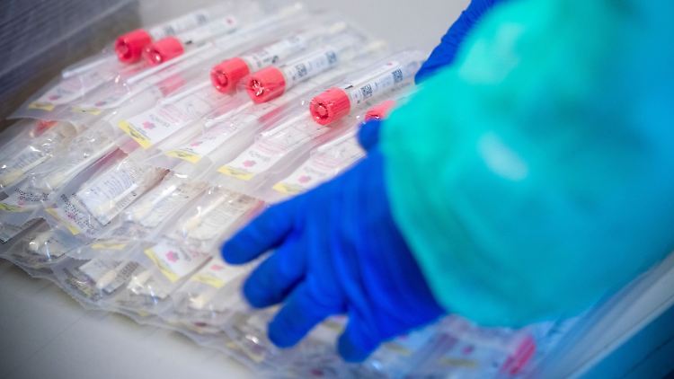 Immer noch rund 400.000 Covid-19-Fälle registrierte das RKI für die vergangene Woche in Deutschland.