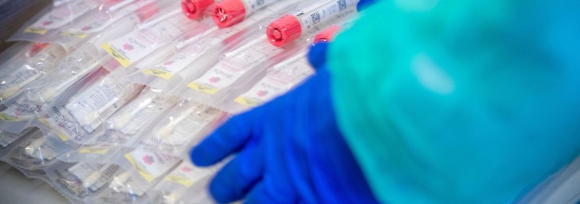 Testsets mit Abstrichstäbchen liegen in einem Testzentrum für Corona-Verdachtsfälle.