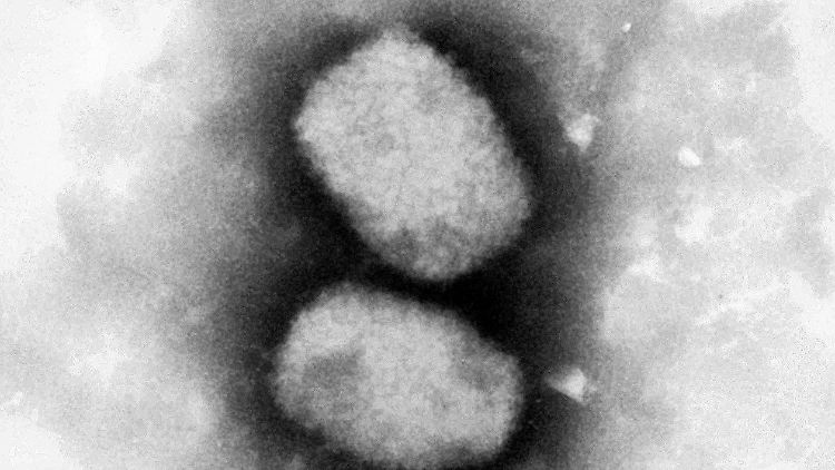 Das Affenpocken-Virus ist eng mit dem Variolavirus verwandt, das die ausgerotteten echten Pocken verursacht.
