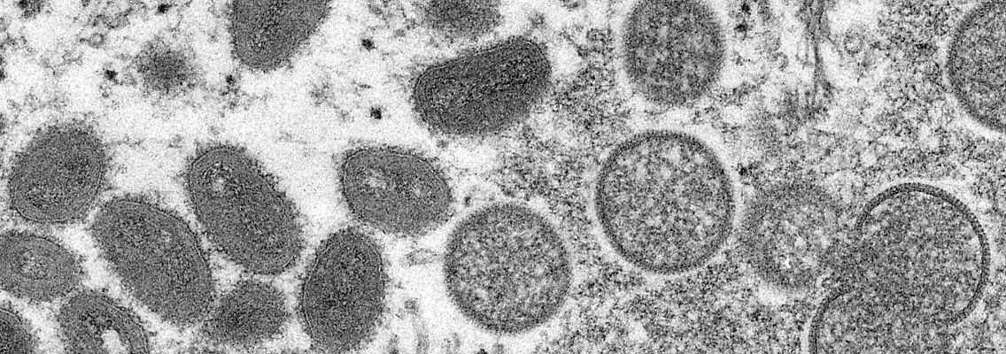 Das Affenpocken-Virus verursacht meist nur milde Symptome.