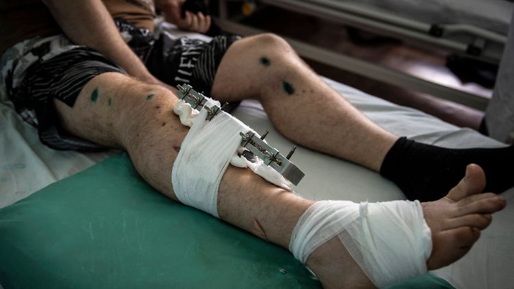 Mehrfache Fraktur, Schrapnell-Wunden: Ein ukrainischer Soldat im Militärkrankenhaus Dnipro hat noch Glück gehabt.