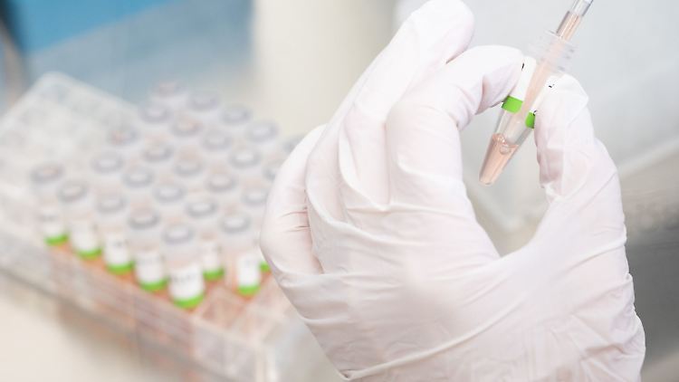 PCR-Tests vor der Analyse