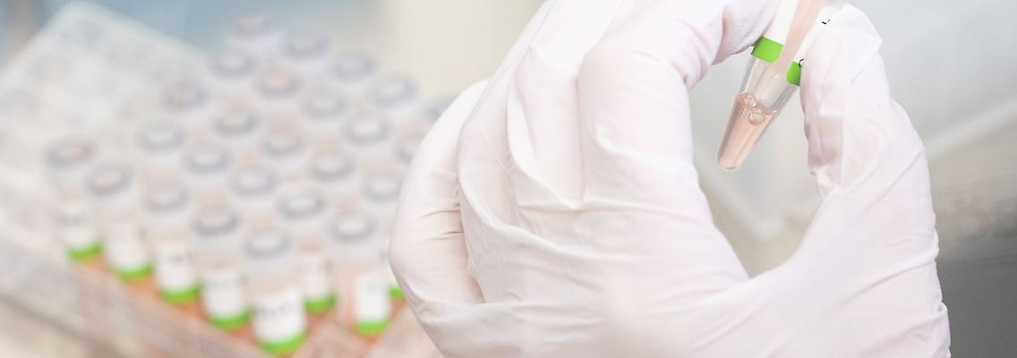Eine biologisch-technische Assistentin bereitet PCR-Tests für die Analyse vor.