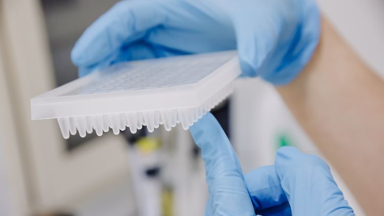 Mit einem PCR-Test lässt sich auch das Affenpocken-Virus nachweisen.