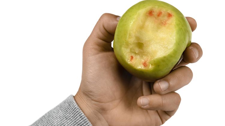 Blutspuren nach dem Abbeißen vom Apfel: Daran merken viele, dass mit ihrem Zahnfleisch was nicht stimmt.