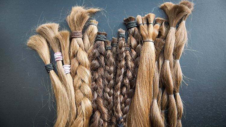 Alopezie ist eine Autoimmunerkrankung, die zu starkem Haarausfall führt.