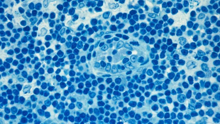 T-Zellen-Immunität gegen Corona ist bislang nur sehr schwer messbar, obwohl sie für den Schutz vor schwerer Erkrankung viel wichtiger ist als Antikörper.