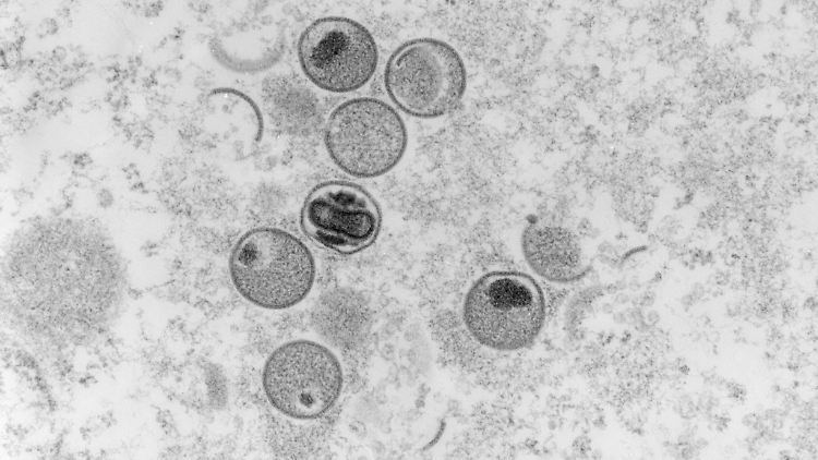 Das Virus ist in immer mehr Ländern nachweisbar.