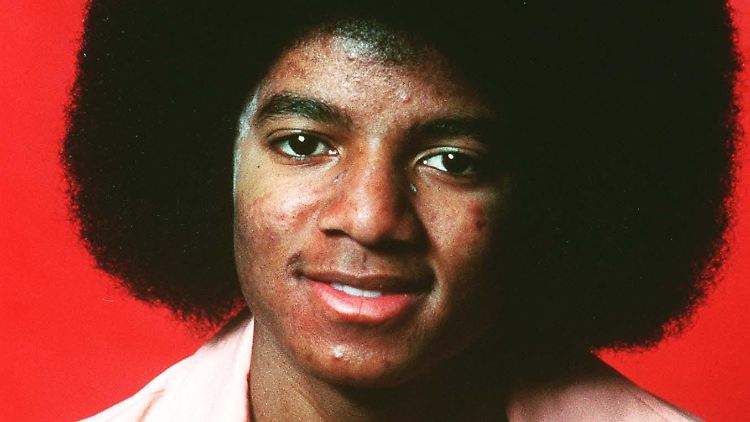 Michael Jackson litt auch an Vitiligo, das bestätigte seine Obduktion.