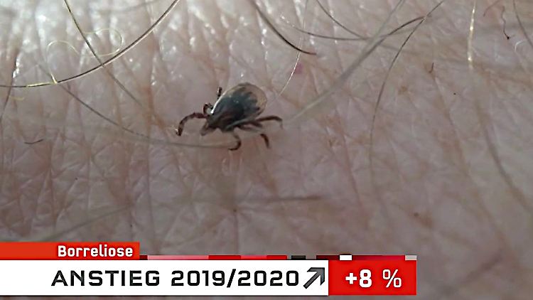 Zecke_Borreliose.JPG