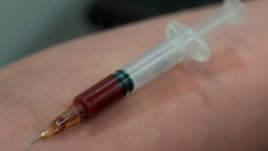 In-Muenchnen-wird-es-nun-doch-keinen-Drogenkonsumraum-geben-den-Abhaengige-fuer-das-Spritzen-von-Drogen-nutzen-koennen