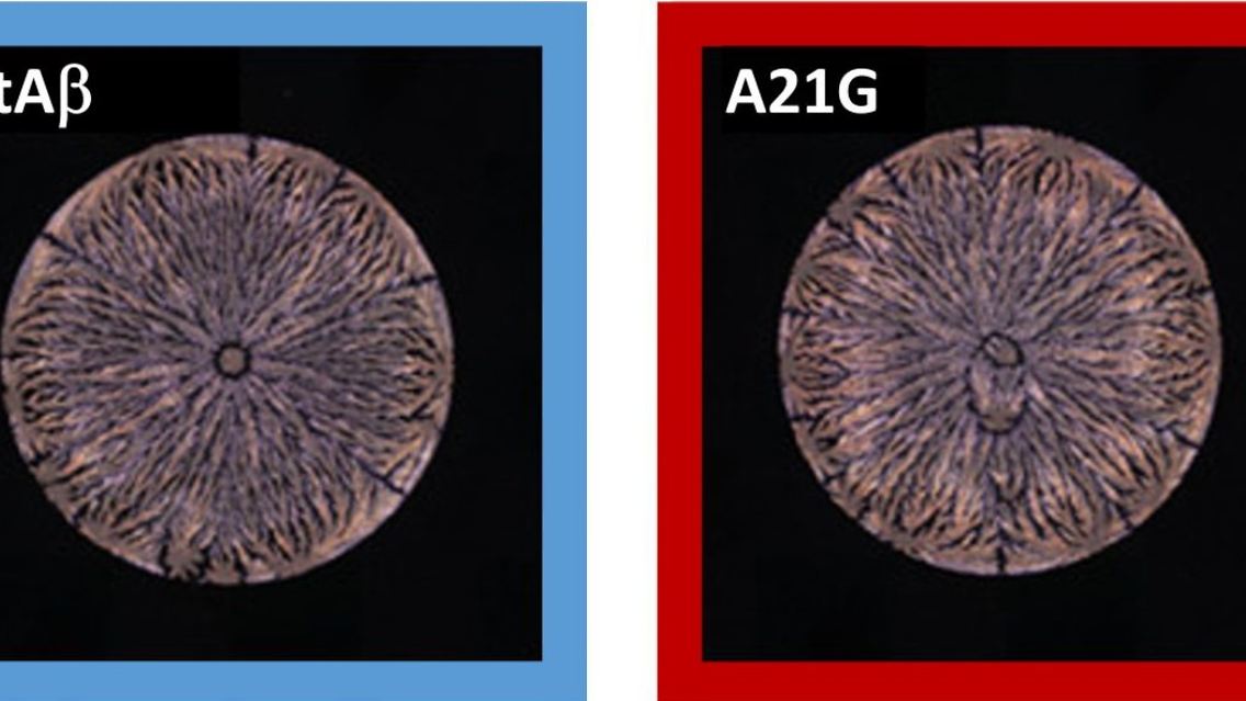 Mit künstlicher Intelligenz werden die Unterschiede erkannt: gesundes Amyloid-Beta-Peptid (l.) und eine Mutation davon (r.).