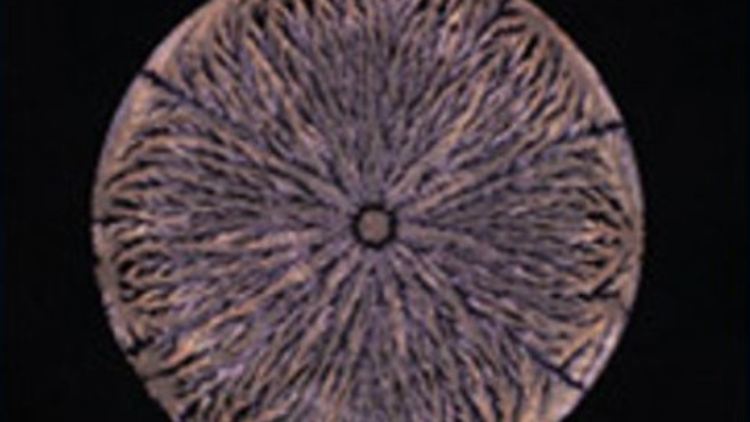So sieht der vergrößerte Trocknungsfleck einer Lösung mit gesunden Amyloid-Beta-Proteinen aus.