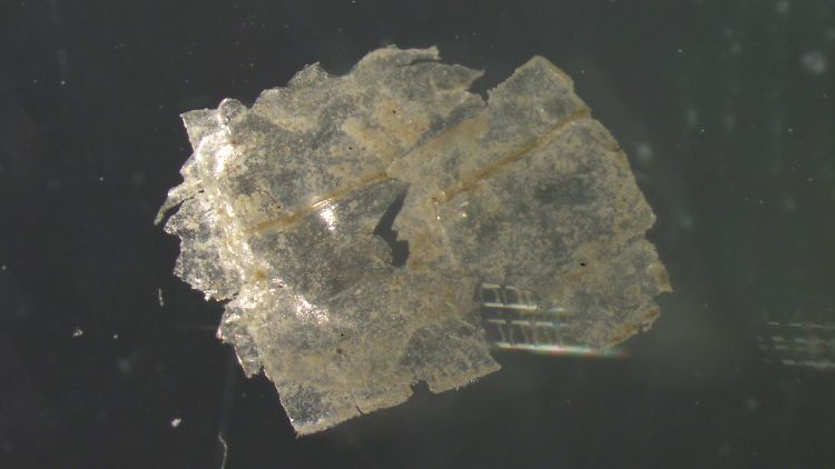In Sedimentproben fanden die Forschenden pro Kilogramm zwischen 215 und 1596 Mikroplastik-Teilchen.