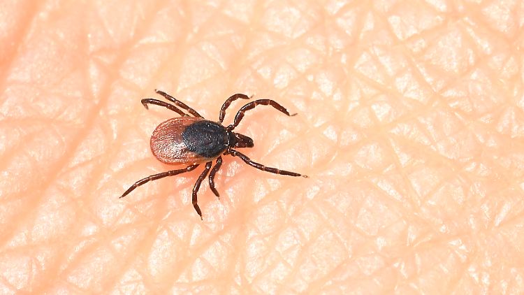 Lyme-Borreliose ist die weltweit häufigste durch Zecken übertragene Infektion.
