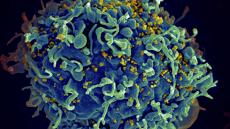 Die hart erkämpften Fortschritte bei der HIV-Bekämpfung drohen verloren zu gehen.