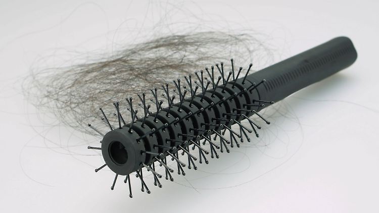 Ein bisher nicht aufgeführtes Long-Covid-Zeichen könnte Haarausfall sein.