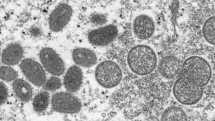 Knapp 4300 Infektionen mit dem Affenpockenvirus wurden bislang in Spanien gemeldet.