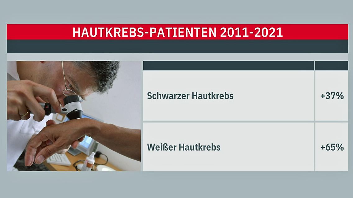 hautkrebs.jpg