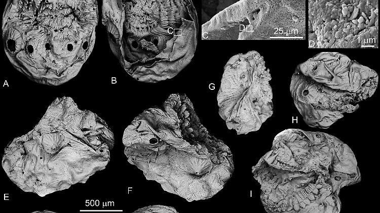 Rasterelektronenmikroskop-Aufnahmen von Saccorhytus coronarius.